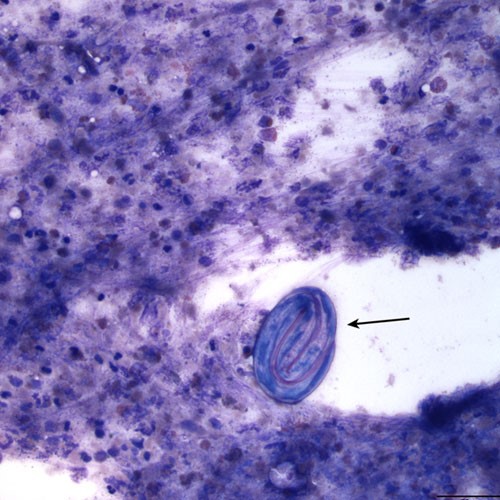 Spermidine Tablets use | Shaanxi BLOOM Tech Co., Ltd Spermidine Tablets use | Shaanxi BLOOM Tech Co., Ltd